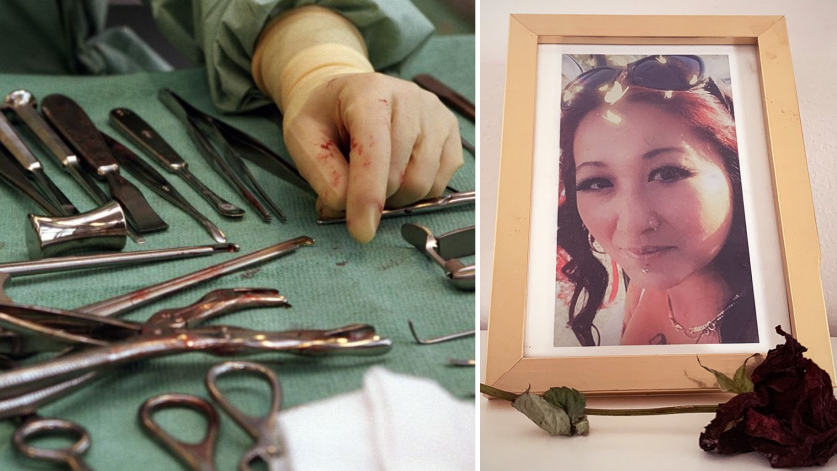 وفاة امرأة سويدية بعد عملية تجميل في تركيا
