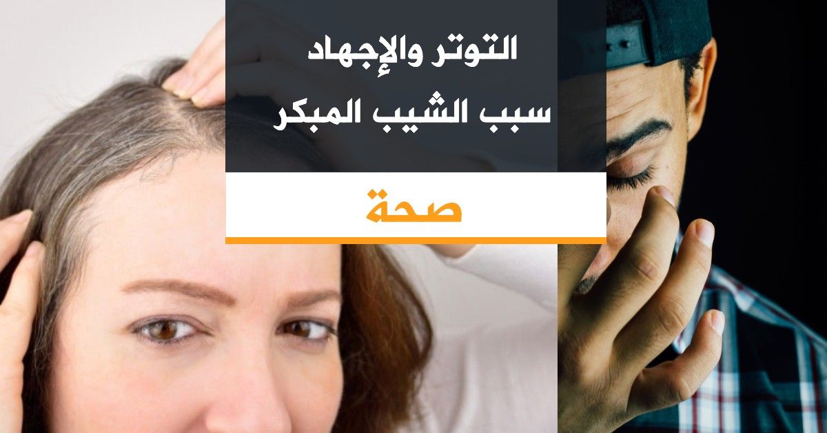 التوتر والإجهاد سبب الشيب المبكر